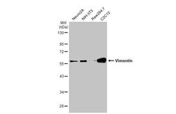 Invitrogen Vimentin Polyclonal Antibody 100 &mu;L; Unconjugated:Antibodies,