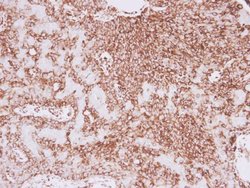 Invitrogen Vimentin Polyclonal Antibody 100 &mu;L; Unconjugated:Antibodies,