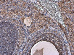 Invitrogen Vimentin Polyclonal Antibody 100 &mu;L; Unconjugated:Antibodies,