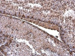 Invitrogen Vimentin Polyclonal Antibody 100 &mu;L; Unconjugated:Antibodies,