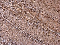 Invitrogen Vimentin Polyclonal Antibody 100 &mu;L; Unconjugated:Antibodies,