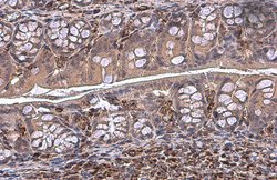 Invitrogen Vimentin Polyclonal Antibody 100 &mu;L; Unconjugated:Antibodies,