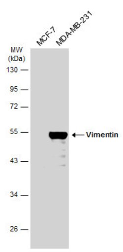 Invitrogen Vimentin Polyclonal Antibody 100 &mu;L; Unconjugated:Antibodies,