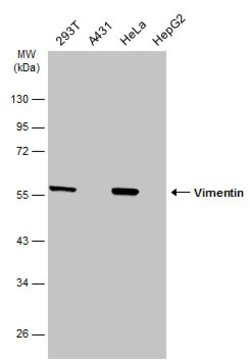 Invitrogen Vimentin Polyclonal Antibody 100 &mu;L; Unconjugated:Antibodies,