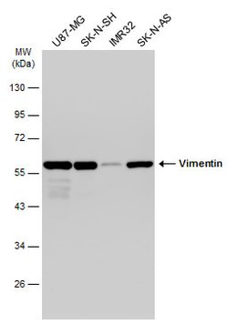 Invitrogen Vimentin Polyclonal Antibody 100 &mu;L; Unconjugated:Antibodies,