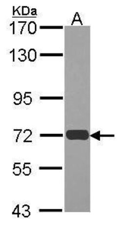 Invitrogen RAD54L Polyclonal Antibody 100 μL; Unconjugated:Antibodies,