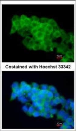 Invitrogen CD36 Polyclonal Antibody 100 &mu;L; Unconjugated:Antibodies,
