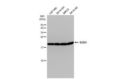 Invitrogen SOD1 Polyclonal Antibody 100 &mu;L; Unconjugated:Antibodies,
