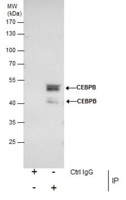 Invitrogen C/EBP beta Polyclonal Antibody 100 &mu;L; Unconjugated:Antibodies,