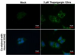 Invitrogen SQSTM1 Polyclonal Antibody 100 μL; Unconjugated:Antibodies,
