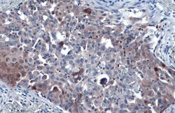 Invitrogen SQSTM1 Polyclonal Antibody 100 μL; Unconjugated:Antibodies,