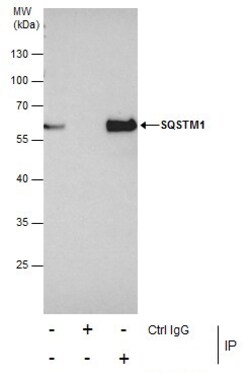 Invitrogen SQSTM1 Polyclonal Antibody 100 μL; Unconjugated:Antibodies,