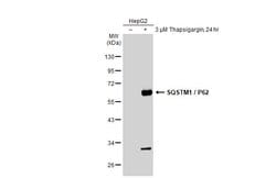 Invitrogen SQSTM1 Polyclonal Antibody 100 μL; Unconjugated:Antibodies,