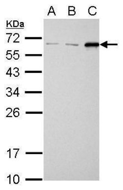 Invitrogen SQSTM1 Polyclonal Antibody 100 μL; Unconjugated:Antibodies,