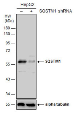 Invitrogen SQSTM1 Polyclonal Antibody 100 μL; Unconjugated:Antibodies,