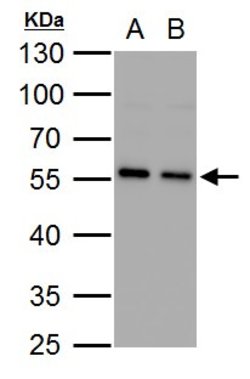 Invitrogen SQSTM1 Polyclonal Antibody 100 μL; Unconjugated:Antibodies,