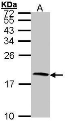 Invitrogen Cystatin S Polyclonal Antibody 100 &mu;L | Buy Online | Invitrogen&trade; | Fisher Scientific