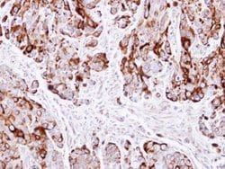 Invitrogen Cytokeratin 20 Polyclonal Antibody 100 &mu;L; Unconjugated:Antibodies,