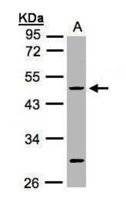 Invitrogen Cytokeratin 20 Polyclonal Antibody 100 &mu;L; Unconjugated:Antibodies,
