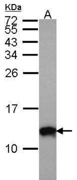 Invitrogen S100A10 Polyclonal Antibody 100 &mu;L; Unconjugated:Antibodies,
