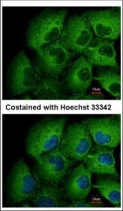 Invitrogen MMP12 Polyclonal Antibody 100 &mu;L | Buy Online | Invitrogen&trade; | Fisher Scientific