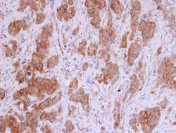 Invitrogen MMP12 Polyclonal Antibody 100 &mu;L | Buy Online | Invitrogen&trade; | Fisher Scientific