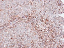 Invitrogen MMP12 Polyclonal Antibody 100 &mu;L | Buy Online | Invitrogen&trade; | Fisher Scientific