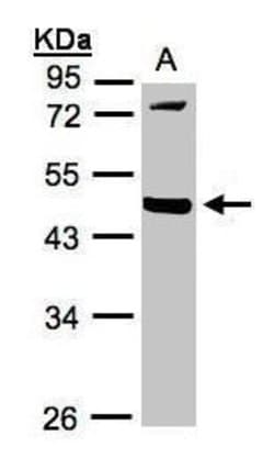 Invitrogen MMP12 Polyclonal Antibody 100 &mu;L | Buy Online | Invitrogen&trade; | Fisher Scientific