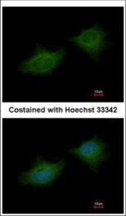 Invitrogen MMP3 Polyclonal Antibody 100 &mu;L; Unconjugated:Antibodies,