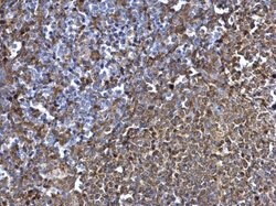 Invitrogen Syk Polyclonal Antibody 100 &mu;L; Unconjugated:Anticuerpos