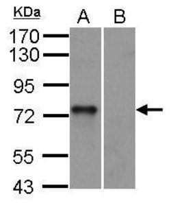 Invitrogen Syk Polyclonal Antibody 100 &mu;L; Unconjugated:Anticuerpos