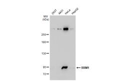 Invitrogen RRM1 Polyclonal Antibody 100 &mu;L; Unconjugated:Antibodies,
