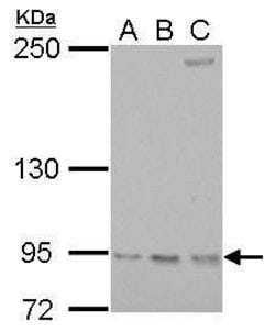Invitrogen RRM1 Polyclonal Antibody 100 &mu;L; Unconjugated:Antibodies,