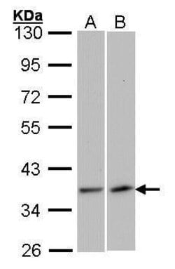 Invitrogen VEGFD Polyclonal Antibody 100 &mu;L | Buy Online | Invitrogen&trade; | Fisher Scientific