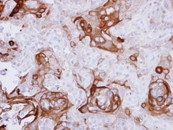 RPSA Polyclonal Antibody, Invitrogen&trade;