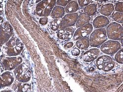 RPSA Polyclonal Antibody, Invitrogen&trade;