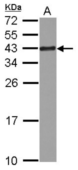 RPSA Polyclonal Antibody, Invitrogen&trade;