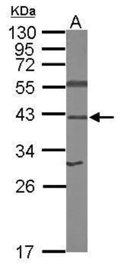 RPSA Polyclonal Antibody, Invitrogen&trade;