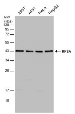 RPSA Polyclonal Antibody, Invitrogen&trade;