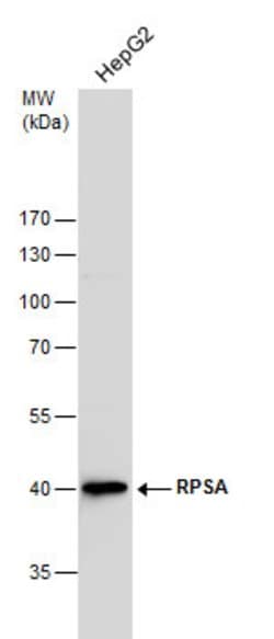 RPSA Polyclonal Antibody, Invitrogen&trade;