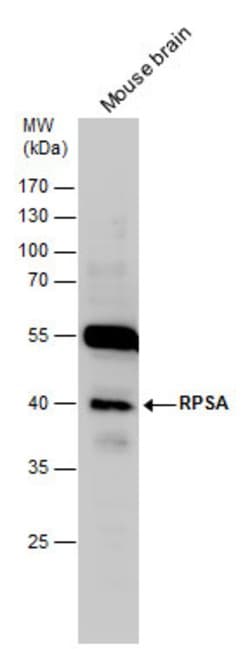 RPSA Polyclonal Antibody, Invitrogen&trade;