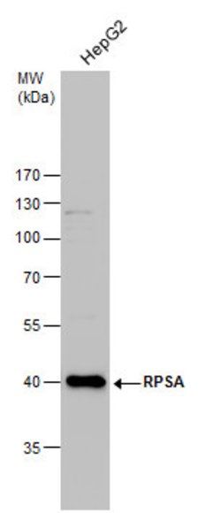 RPSA Polyclonal Antibody, Invitrogen&trade;