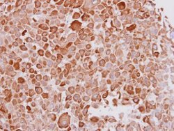 Invitrogen Cytokeratin 16 Polyclonal Antibody 100 &mu;L; Unconjugated:Antibodies,