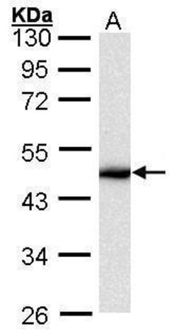 Invitrogen Cytokeratin 16 Polyclonal Antibody 100 &mu;L; Unconjugated:Antibodies,
