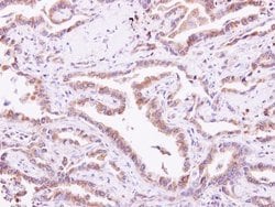 Invitrogen Calmyrin Polyclonal Antibody 100 &mu;L; Unconjugated:Antibodies,