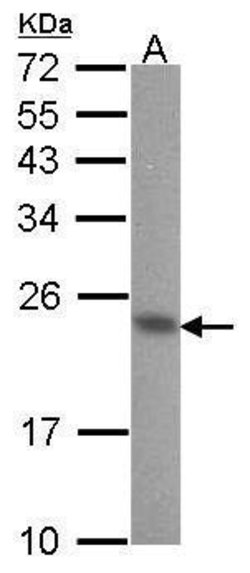 Invitrogen Calmyrin Polyclonal Antibody 100 &mu;L; Unconjugated:Antibodies,