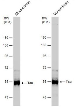 Invitrogen Tau Polyclonal Antibody 100 &mu;L | Buy Online | Invitrogen&trade; | Fisher Scientific