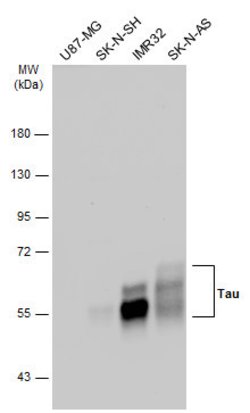 Invitrogen Tau Polyclonal Antibody 100 &mu;L | Buy Online | Invitrogen&trade; | Fisher Scientific