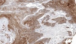 Invitrogen Thymidine Phosphorylase Polyclonal Antibody 100 &mu;L | Buy Online | Invitrogen&trade; | Fisher Scientific