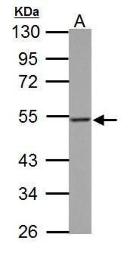 Invitrogen Thymidine Phosphorylase Polyclonal Antibody 100 &mu;L | Buy Online | Invitrogen&trade; | Fisher Scientific
